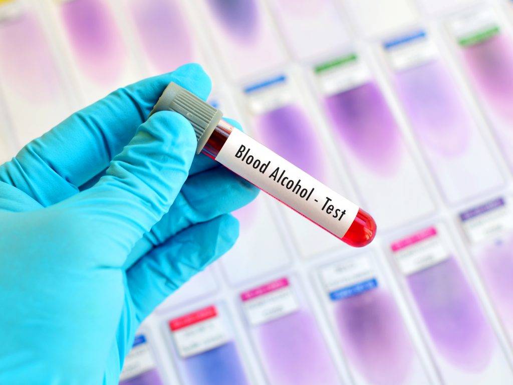 Alcohol Test